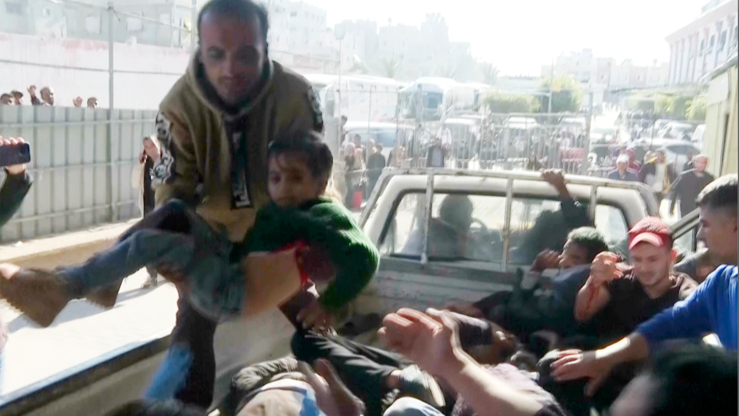 An injured child unloaded from vehicle at Nasser hospital in Khan Younis after an Israeli airstrike on Saturday, Nov. 30, 2024. (AP Photo)